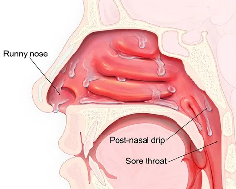 Nasal Congestion Treatments