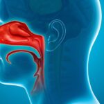 Why Nasal Congestion Treatments Matter For Athletes