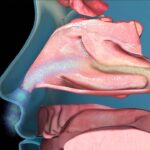 How Nasal Congestion Treatments Clear Blocked Airways